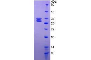 SDS-PAGE analysis of Rat HSF2 Protein. (HSF2 蛋白)