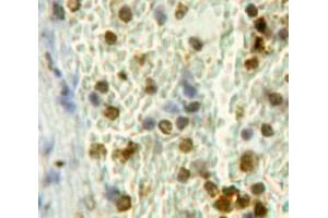 Immunohistochemistry (Paraffin-embedded Sections) (IHC (p)) image for anti-Checkpoint Kinase 2 (CHEK2) (AA 300-540) antibody (ABIN2898796)