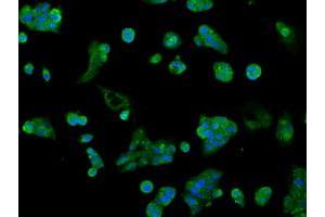Image no. 2 for anti-Aldo-Keto Reductase Family 1, Member A1 (Aldehyde Reductase) (AKR1A1) antibody (ABIN1496539) (AKR1A1 抗体)