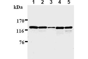 Western Blotting (WB) image for anti-Polymerase (DNA Directed), delta 1, Catalytic Subunit 125kDa (POLD1) antibody (ABIN567776) (POLD1 抗体)