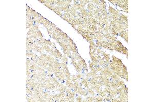 Immunohistochemistry of paraffin-embedded Mouse heart using IFN antibody (ABIN3015562, ABIN3015563, ABIN3015564 and ABIN6218872) at dilution of 1:100 (40x lens).