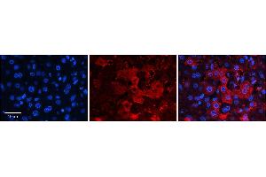 Rabbit Anti-ZNF142 Antibody  Catalog Number: ARP38554_P050 Formalin Fixed Paraffin Embedded Tissue: Human Adult Liver  Observed Staining: Cytoplasm, Membrane in hepatocytes, strong signal, low tissue distribution Primary Antibody Concentration: 1:100 Secondary Antibody: Donkey anti-Rabbit-Cy3 Secondary Antibody Concentration: 1:200 Magnification: 20X Exposure Time: 0. (ZNF142 抗体  (C-Term))