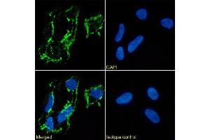 Immunofluorescence (IF) image for anti-Neural Cell Adhesion Molecule 1 (NCAM1) antibody (ABIN7072597)