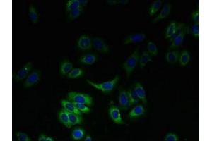 Immunofluorescent analysis of HepG2 cells using ABIN7170179 at dilution of 1:100 and Alexa Fluor 488-congugated AffiniPure Goat Anti-Rabbit IgG(H+L) (SLC23A3 抗体  (AA 391-492))