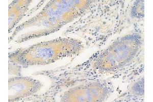 ABIN6264912 and ABIN6269293 at 1/100 staining human normal colon tissue by IHC-P. (RPS6 抗体  (C-Term))