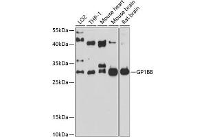 Western blot analysis of extracts of various cell lines, using GP1BB antibody (ABIN6132055, ABIN6141287, ABIN6141288 and ABIN6214244) at 1:1000 dilution. (GP1BB 抗体  (AA 27-147))