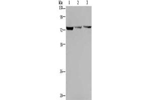 Gel: 8 % SDS-PAGE, Lysate: 40 μg, Lane 1-3: Hela cells, SKOV3 cells, Jurkat cells, Primary antibody: ABIN7130010(KLHL9 Antibody) at dilution 1/300, Secondary antibody: Goat anti rabbit IgG at 1/8000 dilution, Exposure time: 1 minute (KLHL9 抗体)