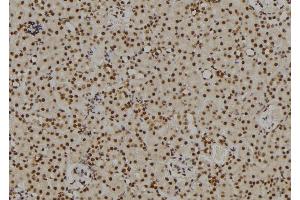 ABIN6264703 and ABIN6269101 at 1/100 staining Rat kidney tissue by IHC-P. (Retinoblastoma 1 抗体  (C-Term))