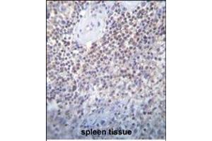 TL2 Antibody (Center) (ABIN655338 and ABIN2844903) immunohistochemistry analysis in formalin fixed and raffin embedded human spleen tissue followed by peroxidase conjugation of the secondary antibody and DAB staining. (PATL2 抗体  (AA 168-196))