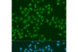 Immunofluorescence analysis of U2OS cells using MSI1 Polyclonal Antibody at dilution of 1:100. (MSI1 抗体)