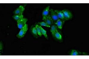 Immunofluorescence (IF) image for anti-Complement Component 1, Q Subcomponent, A Chain (C1QA) (AA 26-125) antibody (ABIN7148332)