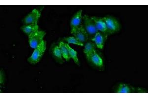 Immunofluorescent analysis of Hela cells using ABIN7148332 at dilution of 1:100 and Alexa Fluor 488-congugated AffiniPure Goat Anti-Rabbit IgG(H+L) (C1QA 抗体  (AA 26-125))