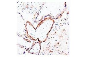 Immunohistochemical analysis of paraffin embedded human placenta sections; staining in cytoplysm; DAB chromogenic reaction (PLGF 抗体  (N-Term))