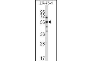 Western blot analysis in ZR-75-1 cell line lysates (35ug/lane). (SGK3 抗体  (C-Term))