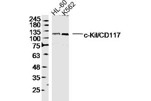 Lane 1: HL-60 lysates Lane 2: K562 lysates probed with c-Kit/CD117 Polyclonal Antibody, Unconjugated  at 1:300 dilution and 4˚C overnight incubation. (KIT 抗体  (AA 451-550))