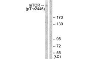 Western blot analysis of extracts from NIH-3T3 cells treated with Insulin 0. (MTOR 抗体  (pThr2446))