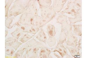 Formalin-fixed and paraffin embedded rat skeletal muscle labeled with Rabbit Anti MYPN Polyclonal Antibody, Unconjugated (ABIN1714212) at 1:200 followed by conjugation to the secondary antibody and DAB staining (Myopalladin 抗体  (AA 901-1000))