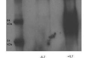 Western Blot and immunoprecipitation of Rabbit anti- IL-7-Receptor-alpha-chain-pY449 antibody.