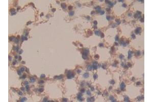 Detection of SOSTDC1 in Mouse Lung Tissue using Polyclonal Antibody to Sclerostin Domain Containing Protein 1 (SOSTDC1) (SOSTDC1 抗体  (AA 24-206))
