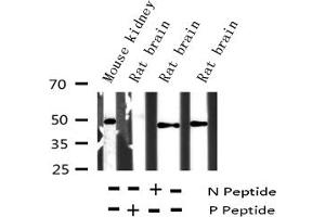 Western Blotting (WB) image for anti-Activating Transcription Factor 2 (ATF2) (pThr55), (pThr73) antibody (ABIN6255708)
