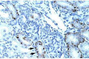 Human kidney (TCFL5 抗体  (Middle Region))