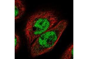 Immunofluorescent staining of human cell line A-431 with IGFALS polyclonal antibody  at 1-4 ug/mL dilution shows positivity in nucleus but not nucleoli. (IGFALS 抗体)