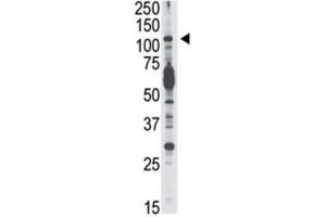 Western Blotting (WB) image for anti-Phosphoinositide-3-Kinase, Catalytic, delta Polypeptide (PIK3CD) antibody (ABIN3003631) (PIK3CD 抗体)