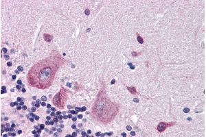 ABIN185398 (3. (DPP10 抗体  (Internal Region))