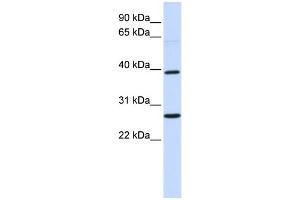 WB Suggested Anti-WNT16 Antibody Titration:  0. (WNT16 抗体  (Middle Region))