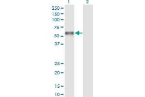 Western Blot analysis of PROC expression in transfected 293T cell line by PROC monoclonal antibody (M01), clone 3A10. (PROC 抗体  (AA 32-131))