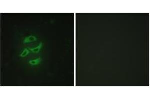 Immunofluorescence (IF) image for anti-Cytochrome P450, Family 2, Subfamily J, Polypeptide 2 (CYP2J2) (AA 231-280) antibody (ABIN1534389)