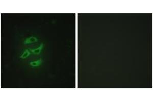 Immunofluorescence analysis of HepG2 cells, using Cytochrome P450 2J2 Antibody. (CYP2J2 抗体  (AA 231-280))