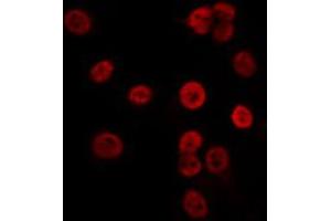 ABIN6274072 staining K562 by IF/ICC. (CDKN1C 抗体  (pThr310))