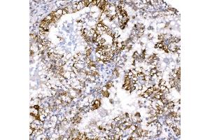 IHC analysis of COX6B1 using anti-COX6B1 antibody (ABIN7603206).