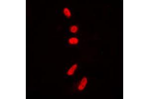 Immunofluorescent analysis of p53 (AcK381) staining in HeLa cells. (p53 抗体  (acLys381, C-Term))
