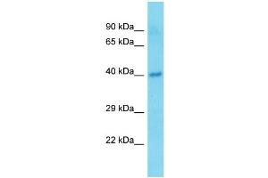 Host:  Rabbit  Target Name:  Tmem25  Sample Type:  Mouse Pancreas lysates  Antibody Dilution:  1. (TMEM25 抗体  (C-Term))