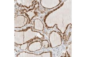 Immunohistochemical staining of human thyroid gland with PARP10 polyclonal antibody  shows distinct cytoplasmic positivity in glandular cells at 1:20-1:50 dilution. (PARP10 抗体)