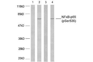 Western blot analysis using NF-κB p65 (phospho-Ser536) antibody (E011014). (NF-kB p65 抗体  (pSer536))