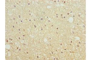 Immunohistochemistry of paraffin-embedded human brain tissue using ABIN7151639 at dilution of 1:100 (SH3G2 抗体  (AA 1-270))