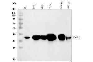 Western blot analysis of PCTP-L/STARD10 using anti-PCTP-L/STARD10 antibody (ABIN7599199).
