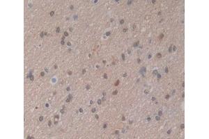 Used in DAB staining on fromalin fixed paraffin- embedded brain tissue (PSMG2 抗体  (AA 1-264))