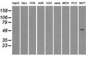 Immunoprecipitation(IP) of SLC2A5 by using TrueMab monoclonal anti-SLC2A5 antibodies (Negative control: IP without adding anti-SLC2A5 antibody. (SLC2A5 抗体)