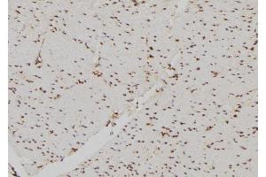 ABIN6269226 at 1/100 staining Human gastric tissue by IHC-P. (DDIT3 抗体  (N-Term))