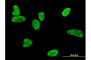Immunofluorescence of monoclonal antibody to BAX on HeLa cell. (BAX 抗体  (AA 1-192))