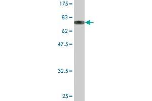 Western Blot detection against Immunogen (83. (YARS 抗体  (AA 1-528))