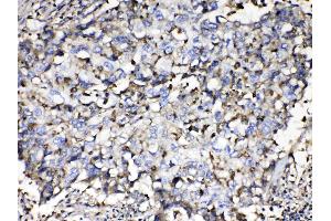 IHC analysis of Beta 2 Microglobulin using anti- Beta 2 Microglobulin antibody .