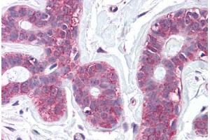 Anti-SLC39A6 antibody  ABIN960811 IHC staining of human breast. (SLC39A6 抗体  (Internal Region))