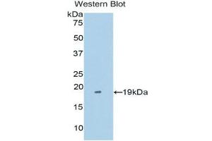 Western Blotting (WB) image for anti-Tumor Necrosis Factor Receptor Superfamily, Member 21 (TNFRSF21) (AA 420-568) antibody (ABIN1176213) (TNFRSF21 抗体  (AA 420-568))