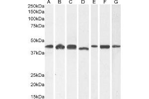 (ABIN185219) (1 μg/mL) staining of A431 (A) and HeLa (B), (2 μg/mL) HEK293 (C) and (0. (ACTR1A 抗体  (C-Term))