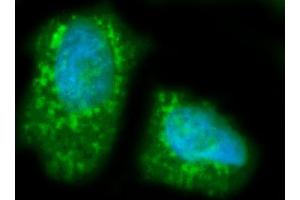 anti-Lipase, Hepatic (LIPC) (AA 39-494) antibody